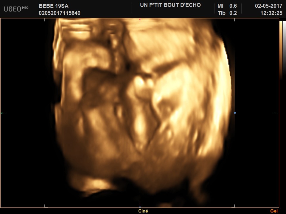 Verdict 19 Sa Echographie Connaitre Le Sexe De Votre Bebe Forum Grossesse Amp Bebe Doctissimo Verdict 19 Sa Echographie Connaitre Le Sexe De Votre Bebe Forum Grossesse Amp Bebe Doctissimo
