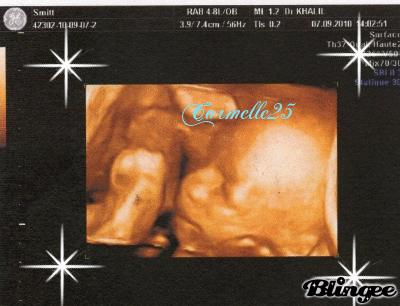 Voici Mon Bebe A 17 Sa 2 En 3d Il Est Trop Beau
