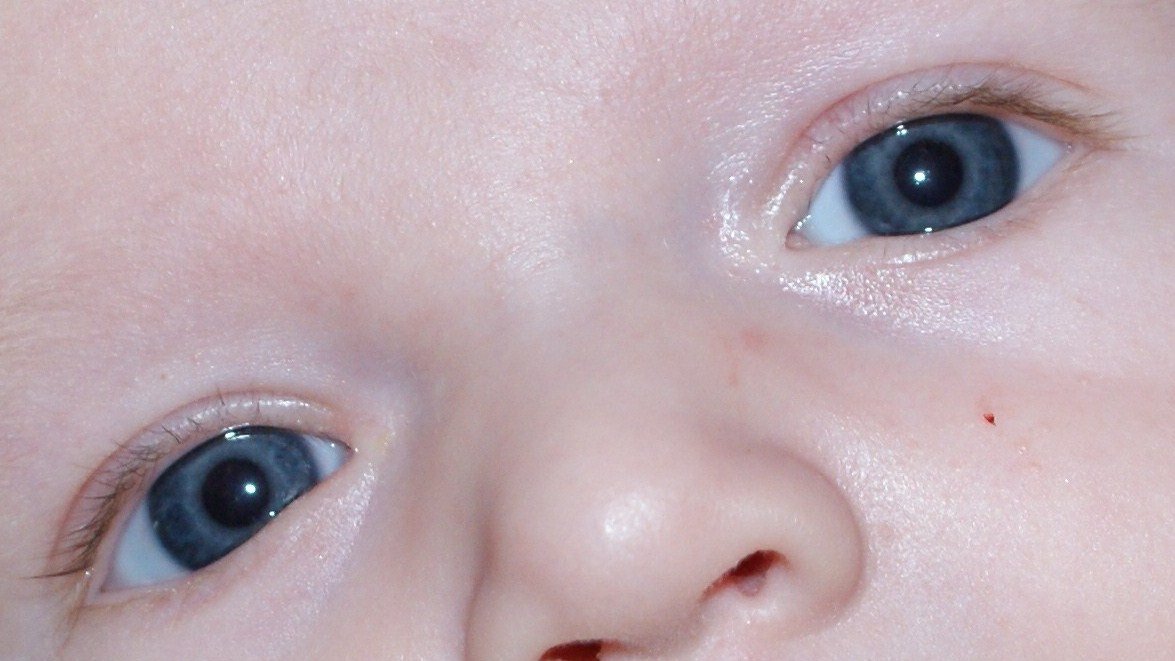 Couleur De Yeux De Bebe Definitive Bebes De L Annee Forum Grossesse Amp Bebe Doctissimo