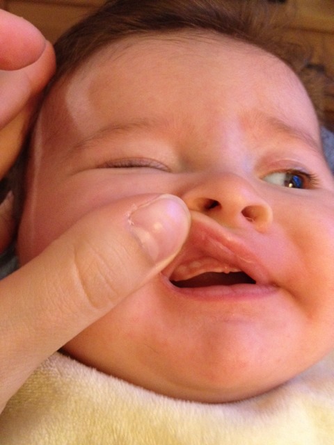 Quenottes Bebe Grandit Forum Grossesse Amp Bebe Doctissimo Quenottes Bebe Grandit Forum Grossesse Amp Bebe Doctissimo