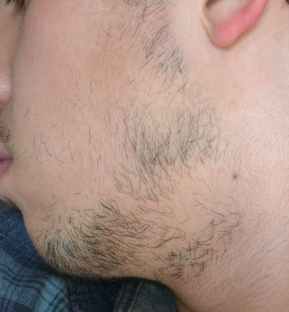 Faire Pousser Barbe Imberbe Style De Barbe