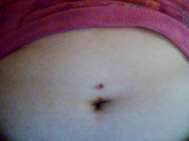 Douleur A Mon Piercing Au Nombril Tatouages Et Piercings Forum Beaute Doctissimo Douleur A Mon Piercing Au Nombril Tatouages Et Piercings Forum Beaute Doctissimo