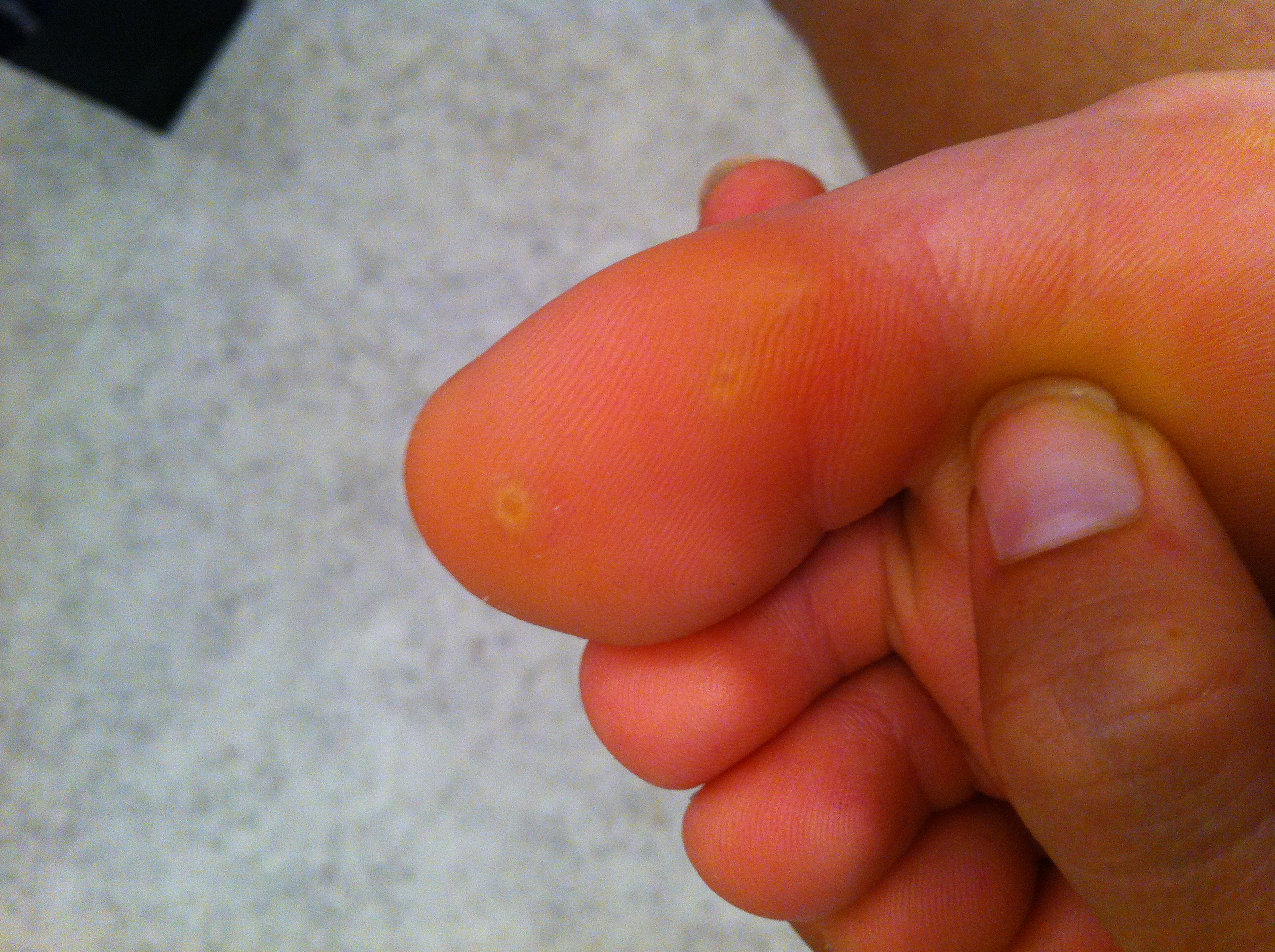 trou dans la peau pied trou dans la peau pied