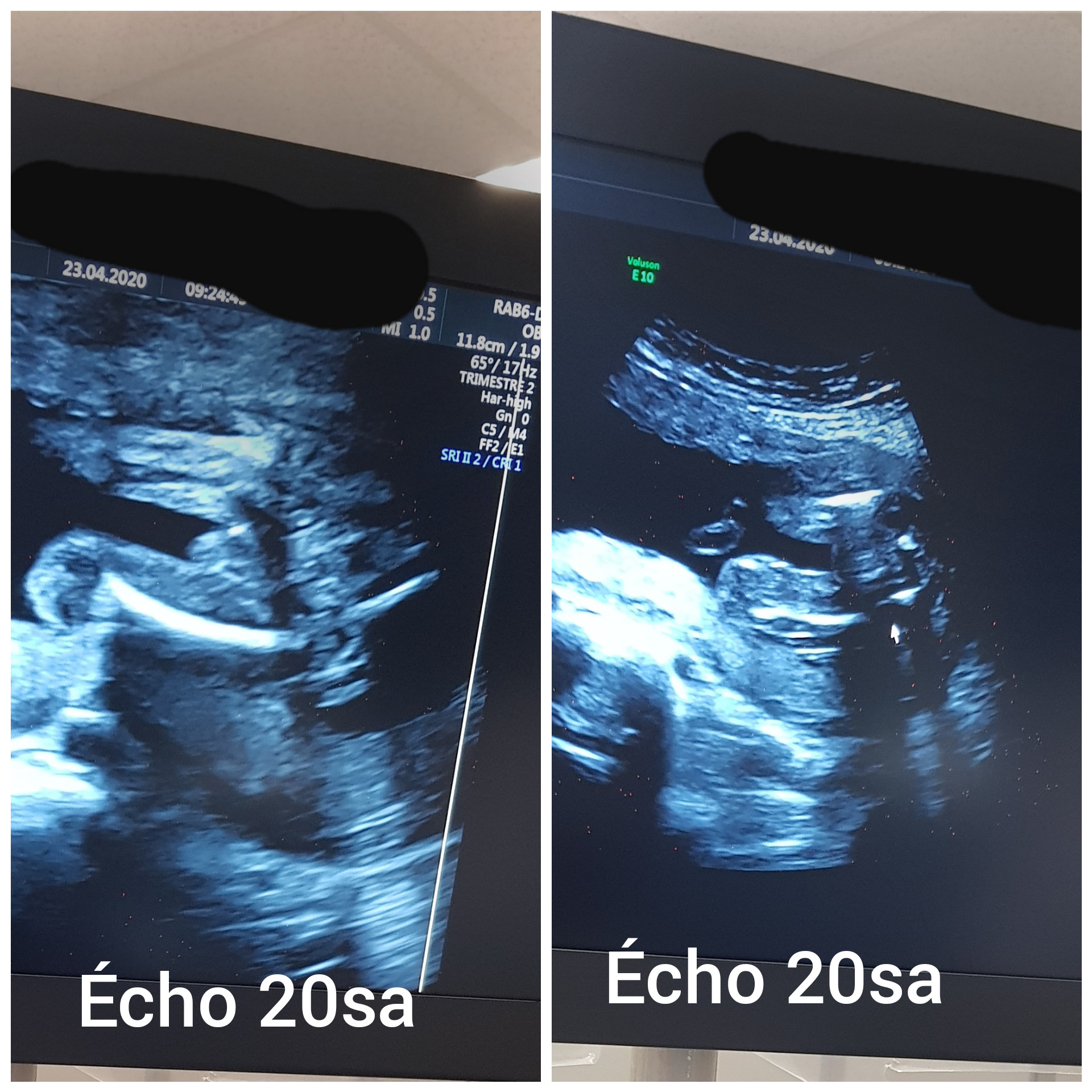 Sexe Echo sa Echographie Connaitre Le Sexe De Votre Bebe Forum Grossesse Amp Bebe Doctissimo