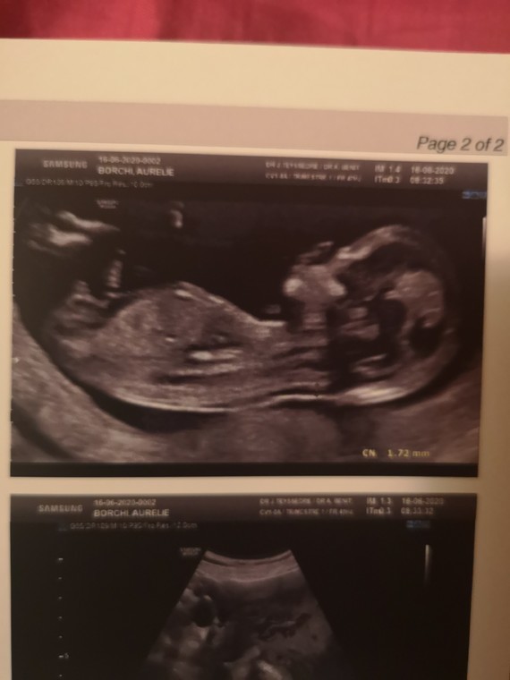 Svp Aide Pour Sexe De Bebe 4 Svp Aide Pour Sexe De Bebe 4