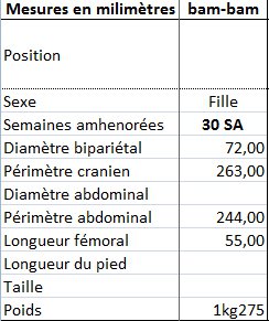 Echo A 30 Sa Qui D Autre Echographie Connaitre Le Sexe De Votre Bebe Forum Grossesse Amp Bebe Doctissimo Echo A 30 Sa Qui D Autre Echographie Connaitre Le Sexe De Votre Bebe Forum Grossesse Amp Bebe Doctissimo