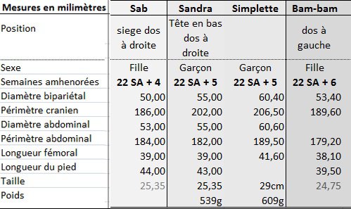 Resultats De Vos Echo Morpho C Est Ici Echographie Connaitre Le Sexe De Votre Bebe Forum Grossesse Amp Bebe Doctissimo