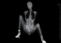 unique_pin-up_calendar_with_x-rayed_photos_of(11)