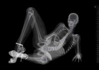 unique_pin-up_calendar_with_x-rayed_photos_of(6)