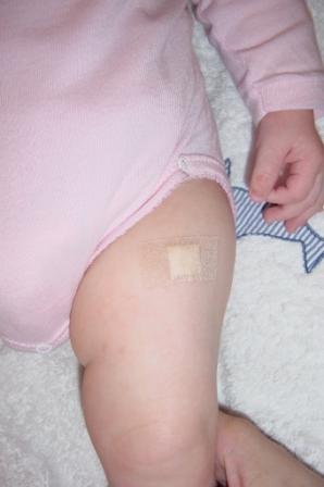 Patch Anesthesiant Bebe Grandit Forum Grossesse Amp Bebe Doctissimo Patch Anesthesiant Bebe Grandit Forum Grossesse Amp Bebe Doctissimo