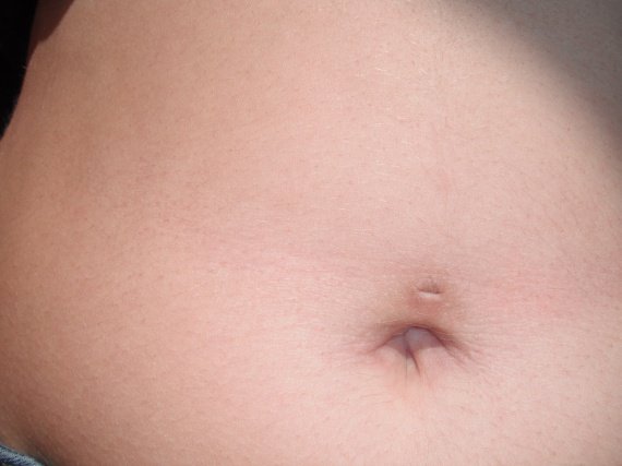 Piercing Nombril Pas Cicatrise Piercing Nombril Pas Cicatrise
