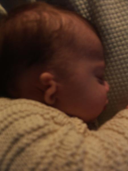 Malformation De L Oreille Audition Surdite Forum Sante Doctissimo Malformation De L Oreille Audition Surdite Forum Sante Doctissimo