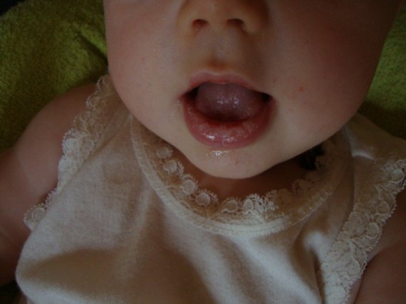 Muguet Ou Pas Muguet Ou Pas