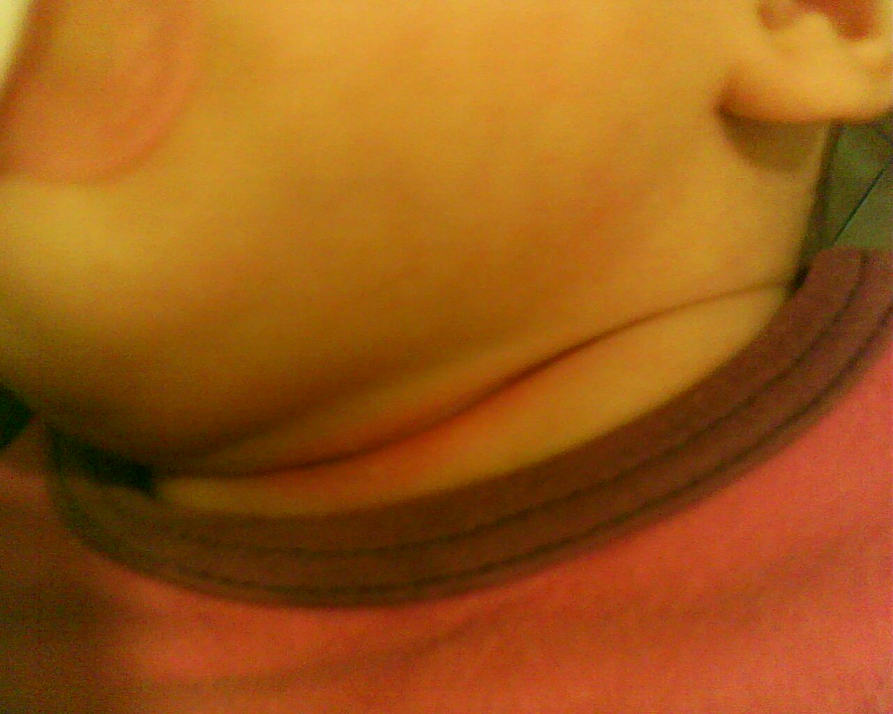 Pli Du Cou Photo Bebe Grandit Forum Grossesse Amp Bebe Doctissimo Pli Du Cou Photo Bebe Grandit Forum Grossesse Amp Bebe Doctissimo