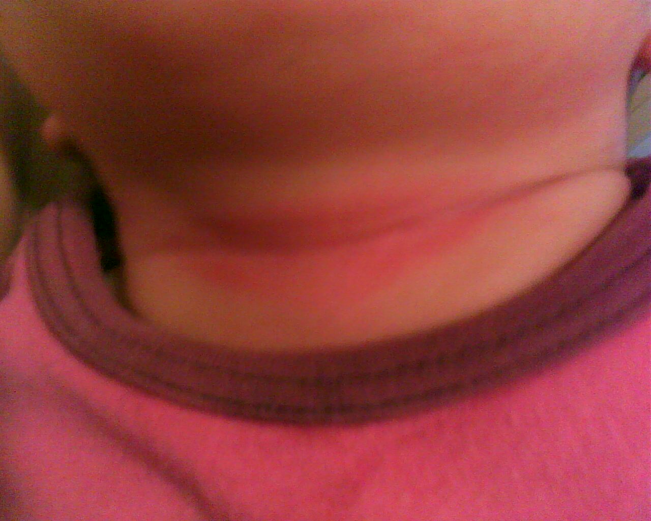 Pli Du Cou Photo Bebe Grandit Forum Grossesse Amp Bebe Doctissimo Pli Du Cou Photo Bebe Grandit Forum Grossesse Amp Bebe Doctissimo