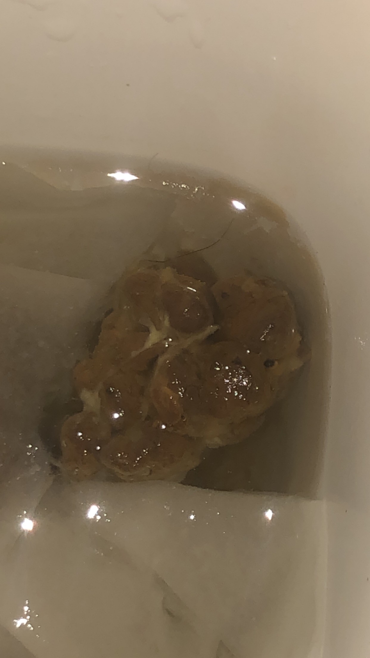 Matiere Blanche Dans Les Selles Constipation Autres Troubles Du Transit Forum Sante Doctissimo Matiere Blanche Dans Les Selles Constipation Autres Troubles Du Transit Forum Sante Doctissimo