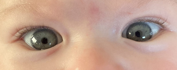 Avis Couleur Yeux Bebe 2 Mois Bebe Grandit Forum Grossesse Amp Bebe Doctissimo