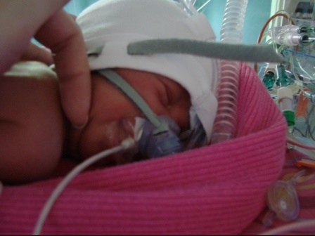Ma Chloe Est Nee A 31sa 4 Suite Pre Eclampsie Et Hellp Syndrom Prematures Forum Grossesse Amp Bebe Doctissimo Ma Chloe Est Nee A 31sa 4 Suite Pre Eclampsie Et Hellp Syndrom Prematures Forum Grossesse Amp Bebe Doctissimo