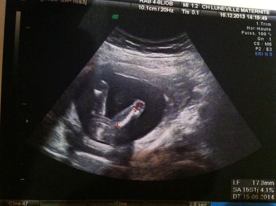 Me Revoila Avec Une Nouvelle Echo A 16 Sa Me Revoila Avec Une Nouvelle Echo A 16 Sa