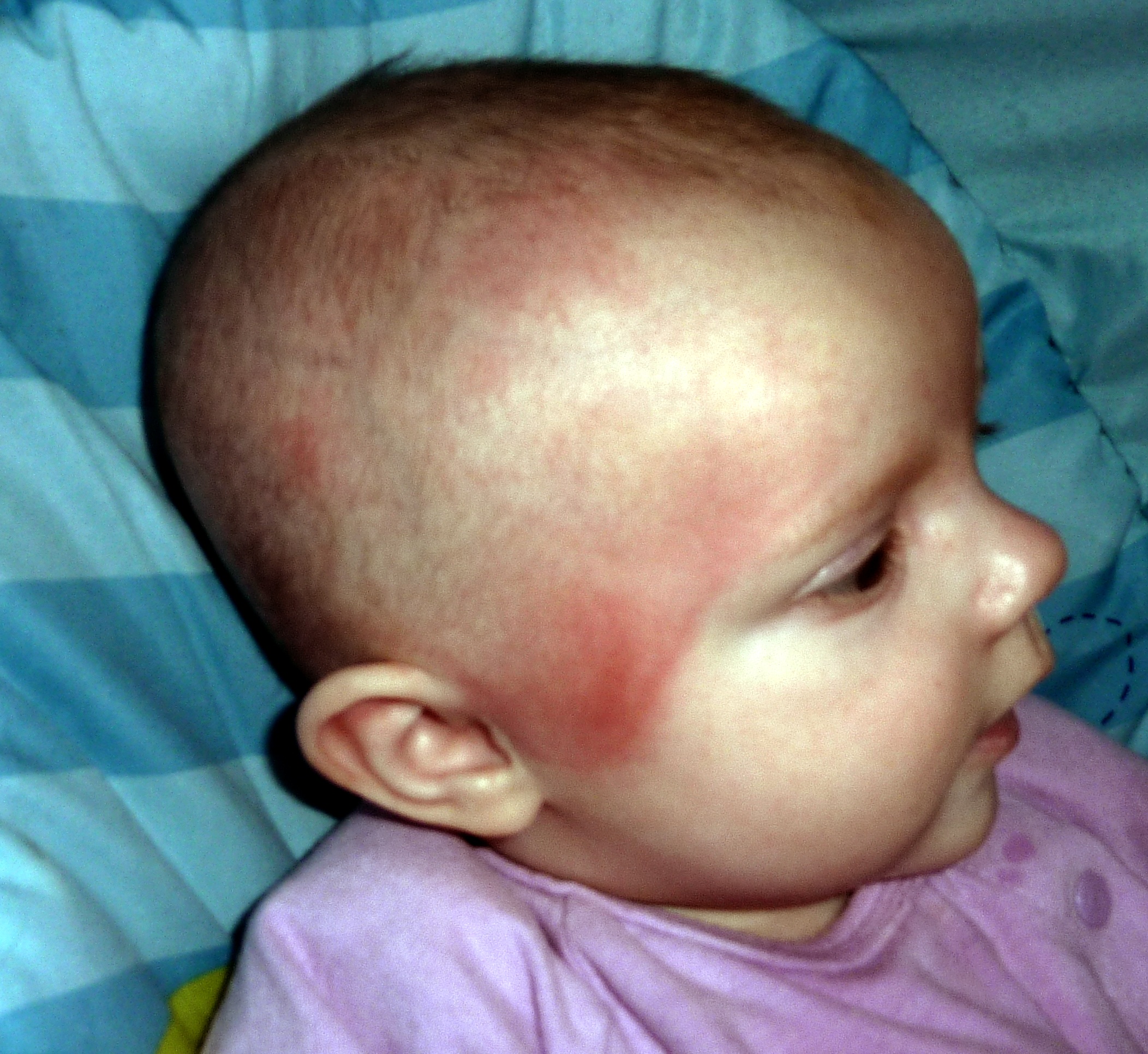 Blessure Cause Par Le Casque Mamans Et Futures Mamans Du Quebec Forum Grossesse Amp Bebe Doctissimo Blessure Cause Par Le Casque Mamans Et Futures Mamans Du Quebec Forum Grossesse Amp Bebe Doctissimo