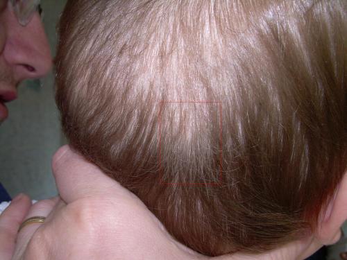 Ses Premiers Cheveux Blancs Bebe Grandit Forum Grossesse Amp Bebe Doctissimo Ses Premiers Cheveux Blancs Bebe Grandit Forum Grossesse Amp Bebe Doctissimo