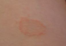 Tache étrange... Qu'est-ce que c'est?