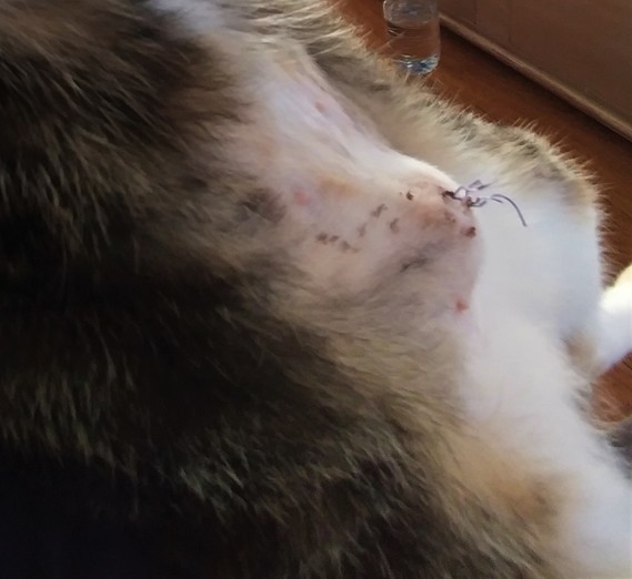 Boule Douloureuse Apres Sterilisation Boule Douloureuse Apres Sterilisation