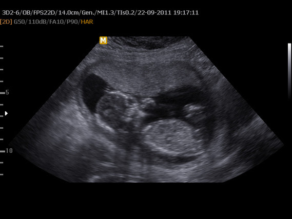 11-09-22 bébé (12)