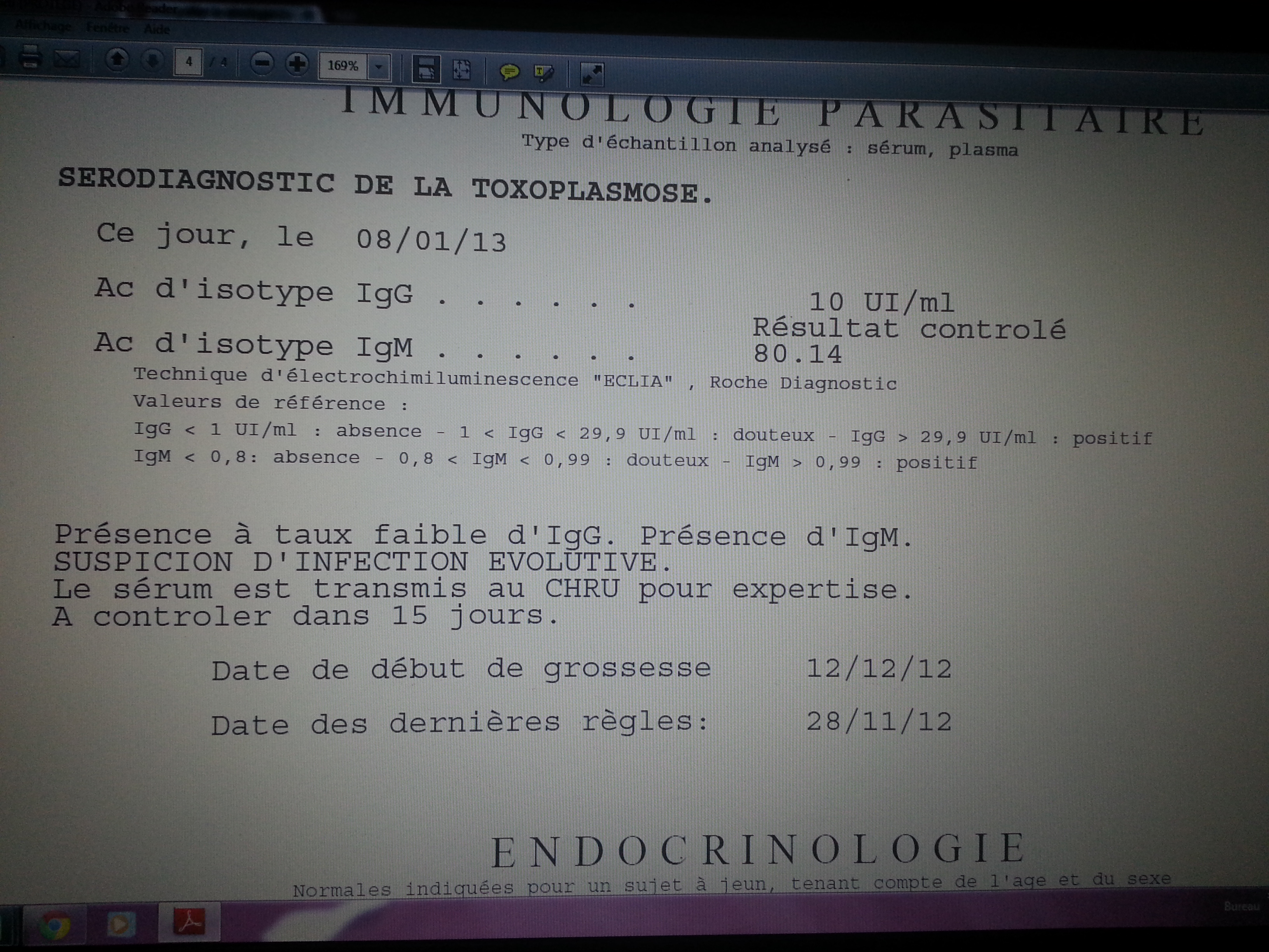 Enceinte De 1 Mois Et Toxoplasmose Je Suis Perdu Maladies Infectieuses Et Grossesse Forum Grossesse Amp Bebe Doctissimo Enceinte De 1 Mois Et Toxoplasmose Je Suis Perdu Maladies Infectieuses Et Grossesse Forum Grossesse Amp Bebe Doctissimo