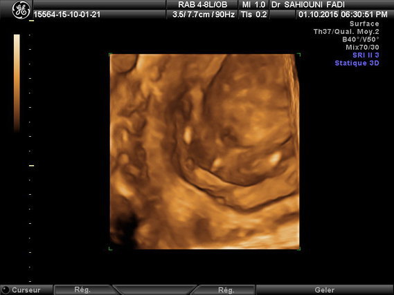 Nouvelle Echo A 16 Sa Fille Ou Gars Qu En Pensez Vous Nouvelle Echo A 16 Sa Fille Ou Gars Qu En Pensez Vous