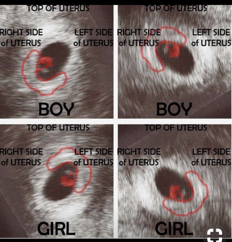 Sexe Bebe Dites Moi Echographie Connaitre Le Sexe De Votre Bebe Forum Grossesse Amp Bebe Doctissimo Sexe Bebe Dites Moi Echographie Connaitre Le Sexe De Votre Bebe Forum Grossesse Amp Bebe Doctissimo