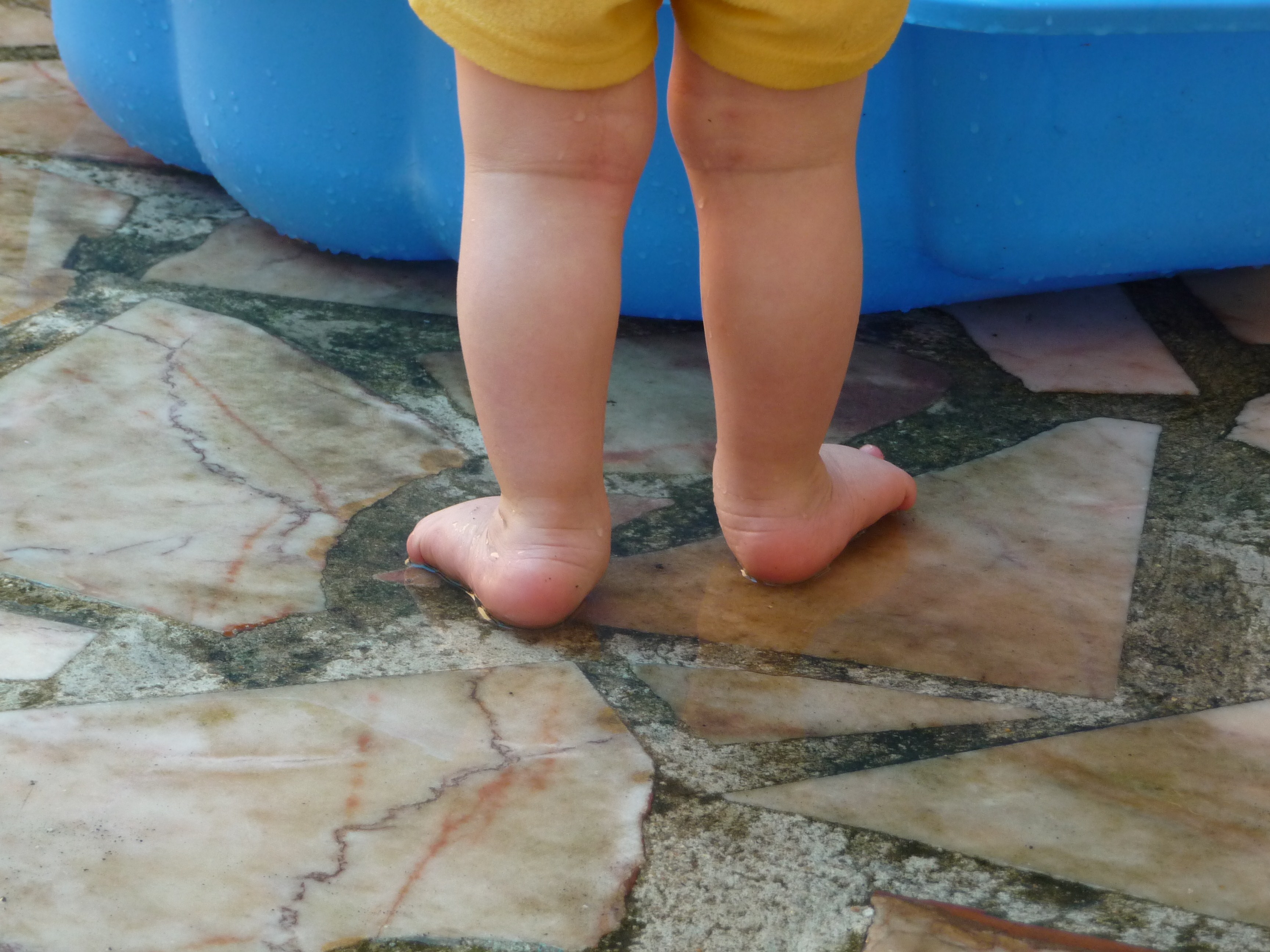 Temoignage Pieds Valgus Chez L Enfant Developpement De L Enfant Forum Grossesse Amp Bebe Doctissimo Temoignage Pieds Valgus Chez L Enfant Developpement De L Enfant Forum Grossesse Amp Bebe Doctissimo