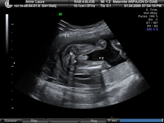 Echo 23 Sa A Quoi Pensez Vous Echo 23 Sa A Quoi Pensez Vous