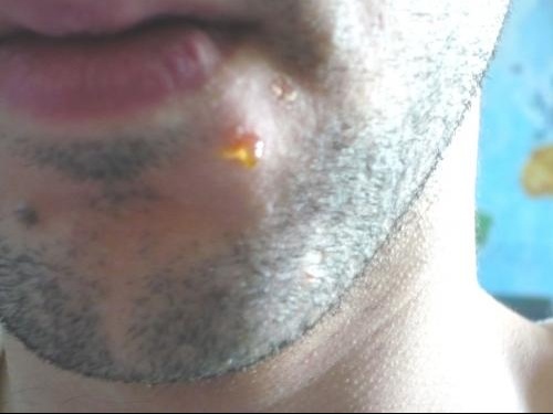 Bouton Jaune De Miel Qui Ne Partent Pas Bouton Jaune De Miel Qui Ne Partent Pas