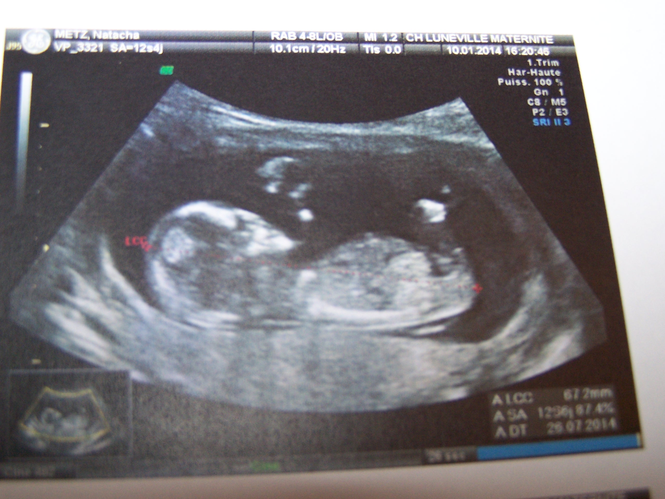 مطعم الطفل المولود قبل اوانه مكتبة الجذع 12 Sa De Jumeaux Deux Sacs St Dekom Com مطعم الطفل المولود قبل اوانه مكتبة الجذع 12 Sa De Jumeaux Deux Sacs St Dekom Com