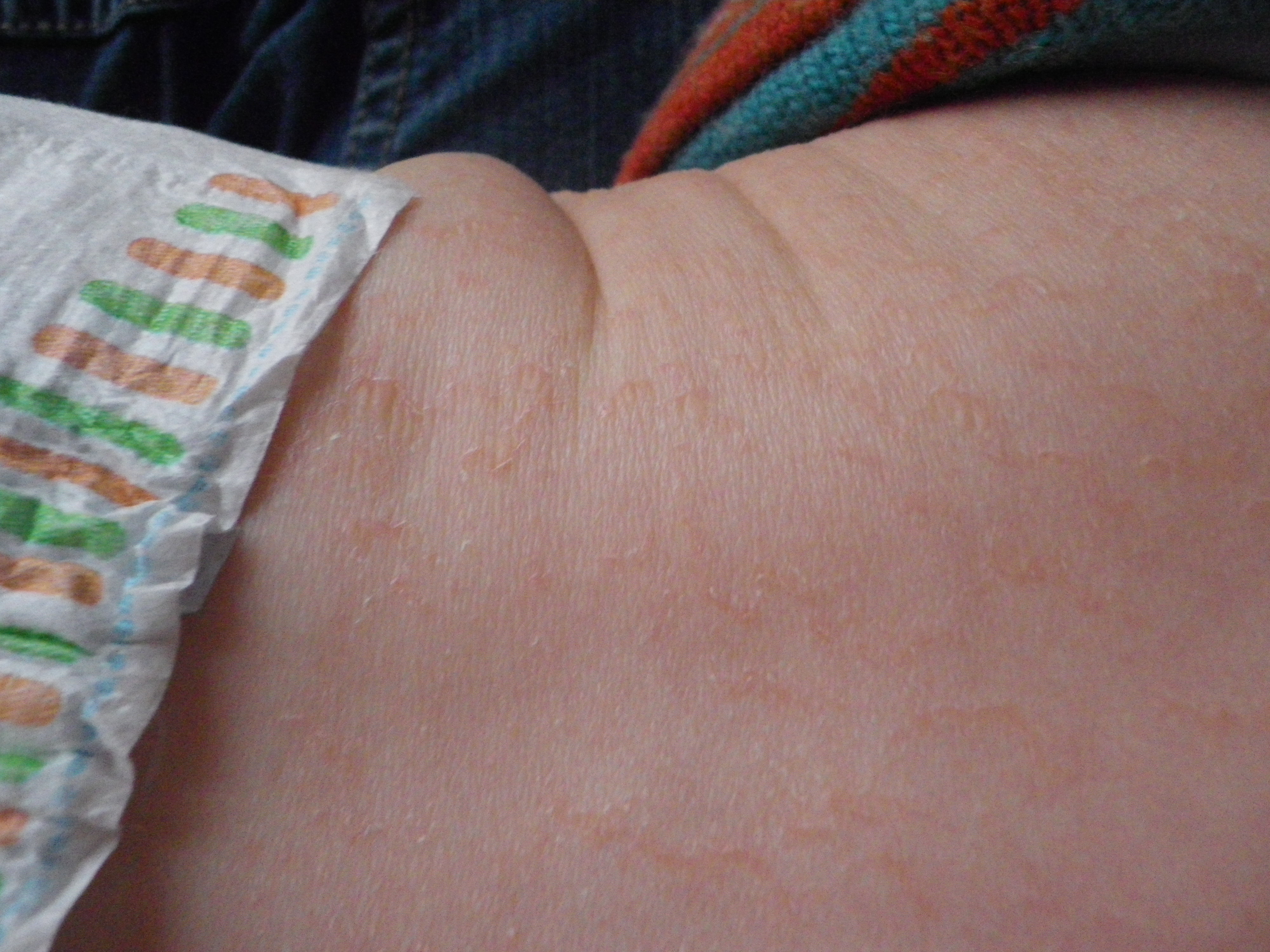 C Est Rare Mais La Je M Inquiete Photo Bebe Grandit Forum Grossesse Amp Bebe Doctissimo C Est Rare Mais La Je M Inquiete Photo Bebe Grandit Forum Grossesse Amp Bebe Doctissimo