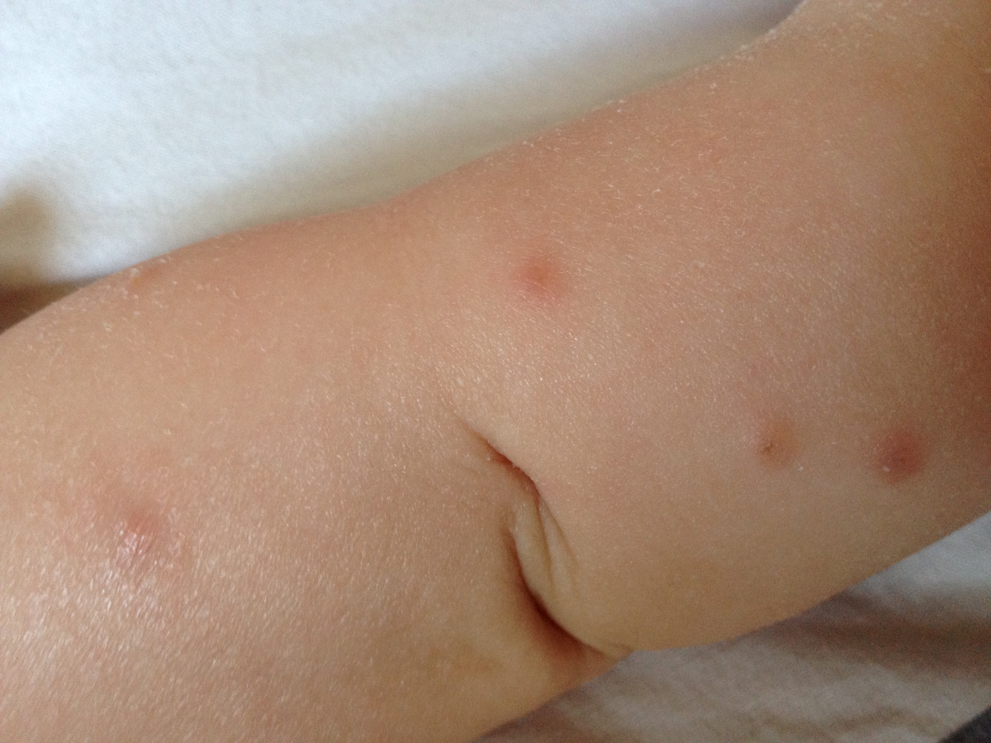Nos Amis Les Moustiques Bebe Grandit Forum Grossesse Amp Bebe Doctissimo Nos Amis Les Moustiques Bebe Grandit Forum Grossesse Amp Bebe Doctissimo