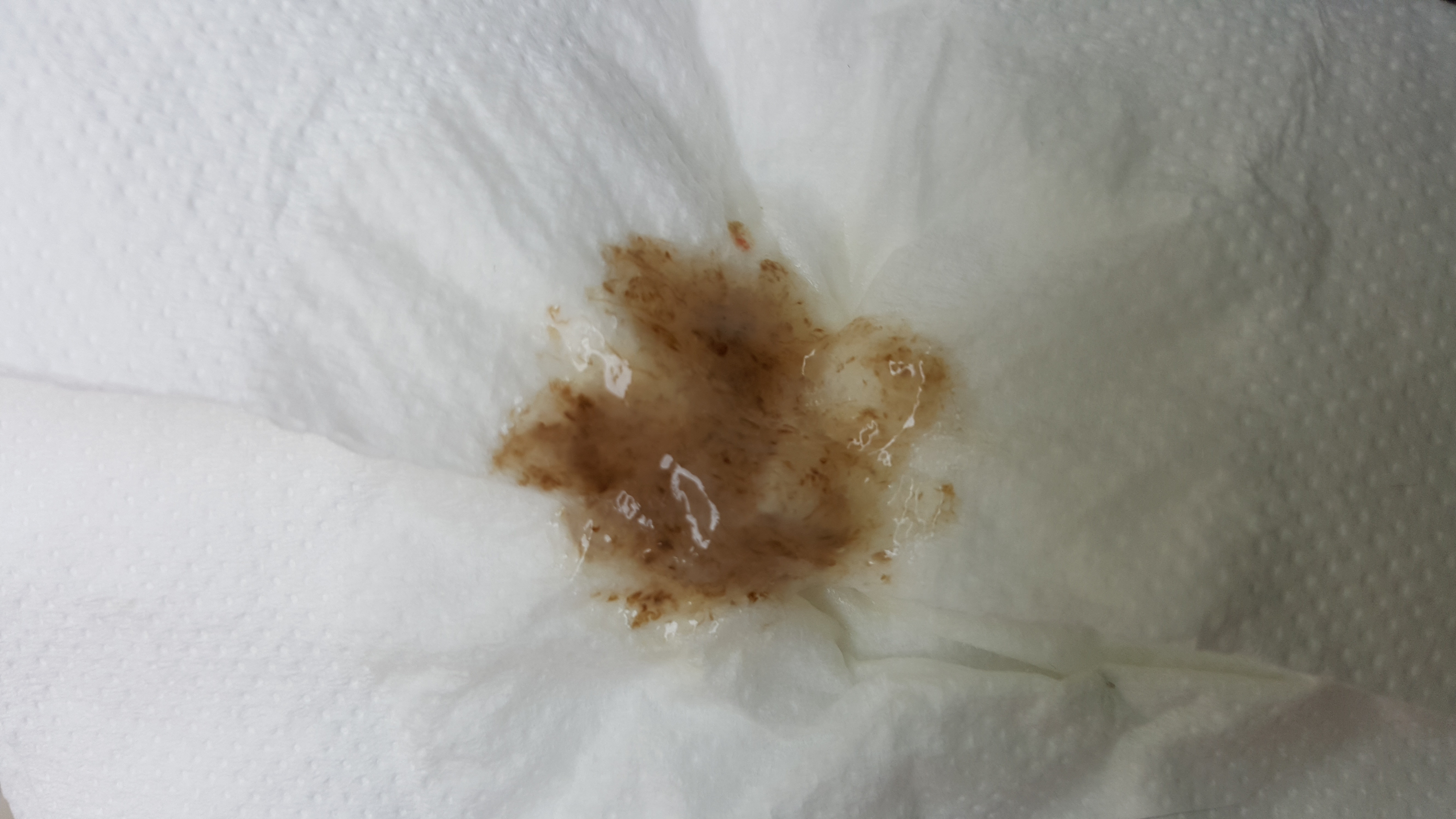 Glaire Suite A L Arret Du Tabac Arreter De Fumer Forum Sante Doctissimo