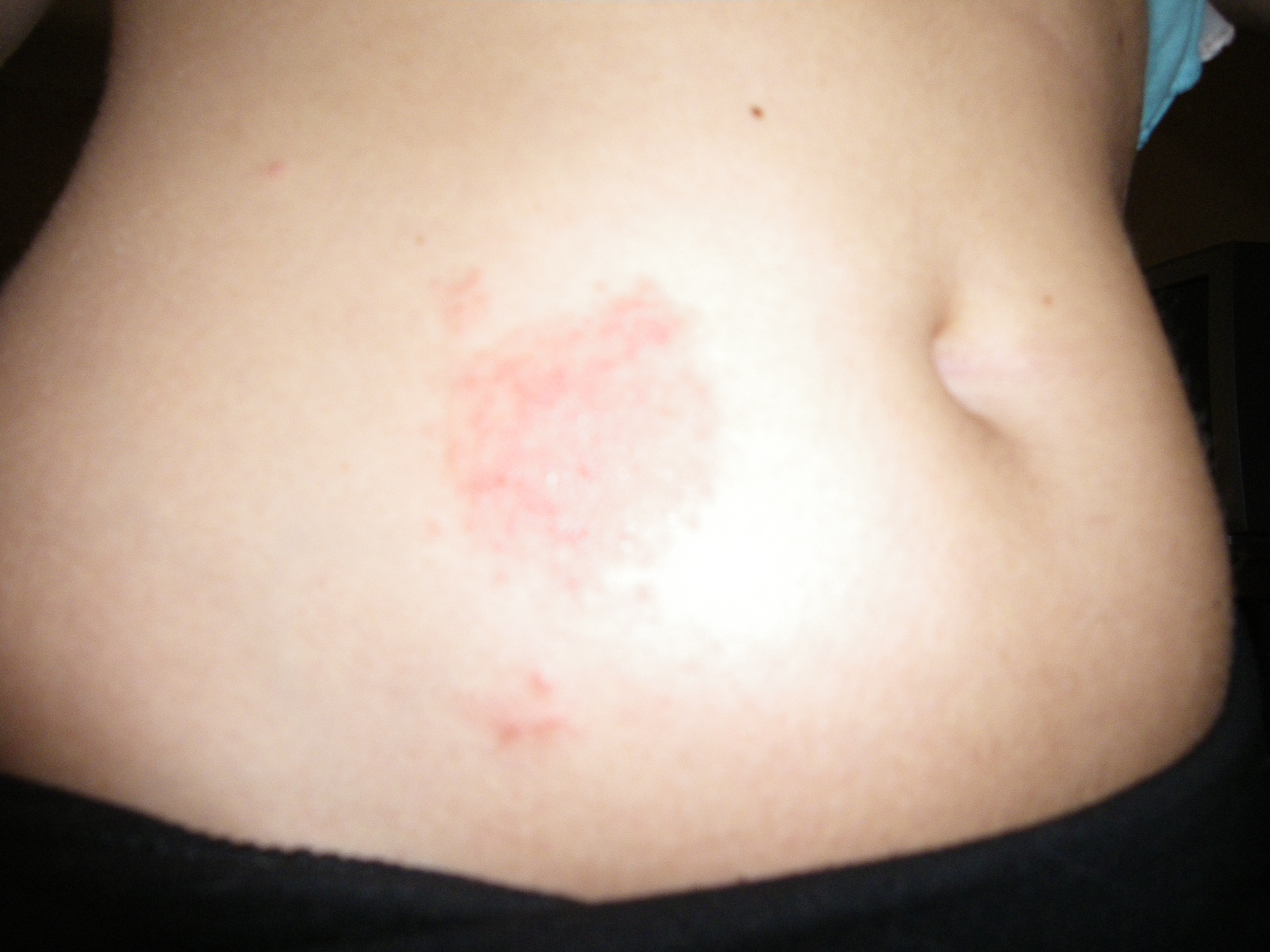 Plaque Rouge Sur Le Ventre Medecine Veterinaire Forum Animaux Doctissimo Plaque Rouge Sur Le Ventre Medecine Veterinaire Forum Animaux Doctissimo